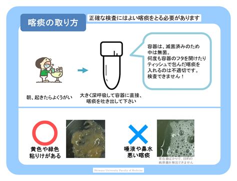 痰培養 採取方法 吸引 看護|微生物検査に適した 検体採取と感染対策